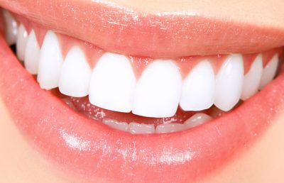 bfc_orthodontics_price bfc_orthodontics_price